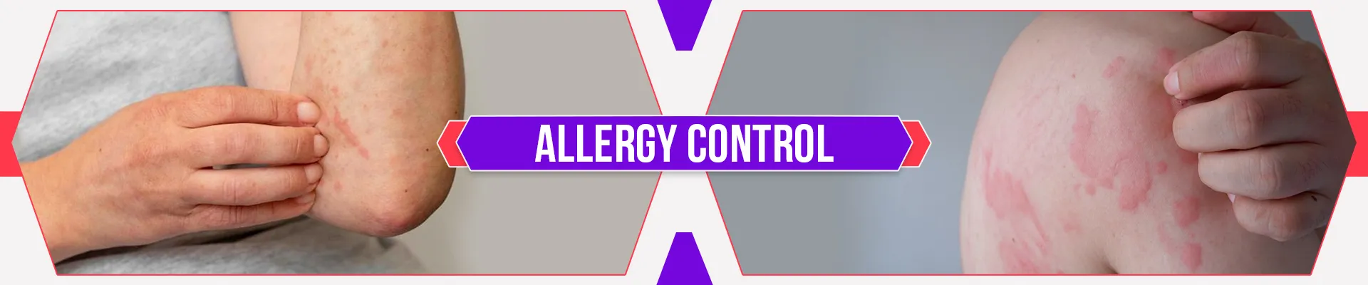 carpet cleaners in Brooklyn, carpet cleaning in Brooklyn, carpet cleaning bkln, carpet cleaners in brooklyn,  commercial carpet cleaning, commercial carpet cleaning in brooklyn,carpet cleaning in brooklyn,  brooklyn rug cleaners, rug cleaning services in brooklyn, same day carpet cleaning, same day rug cleaning